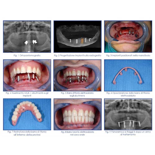 toronto - eurodental ravenna